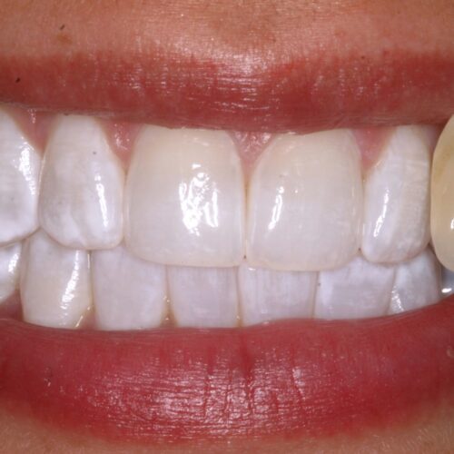 after dentistry at Sea of Pearls Dental Boutique