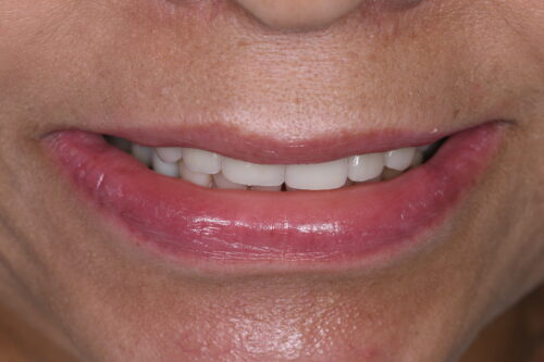 after dentistry at Sea of Pearls Dental Boutique