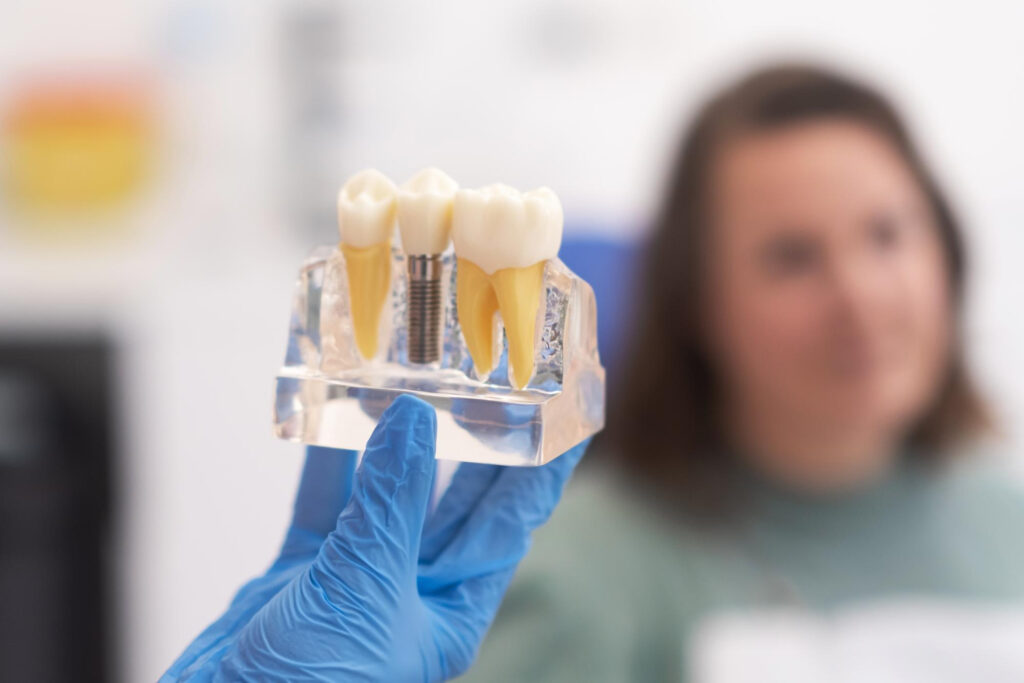 single tooth implants