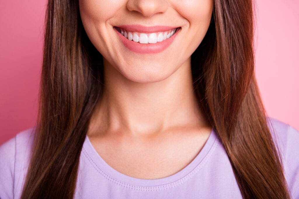 Dental Crowns vs. Porcelain Veneers