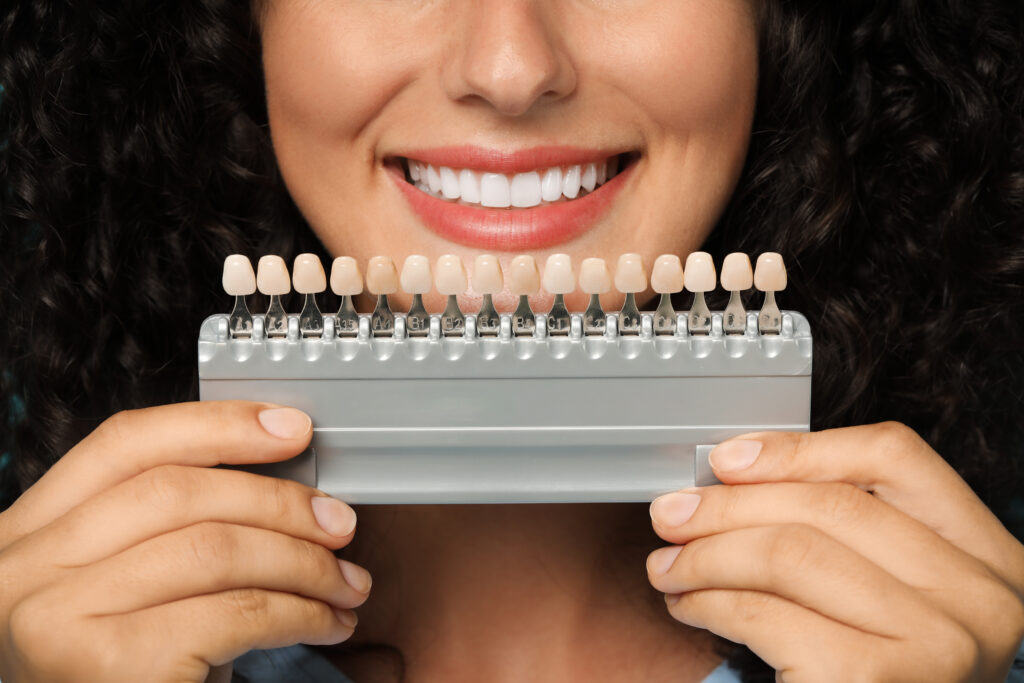 Porcelain Veneers in East Cobb – Sea of Pearls Dental Boutique
