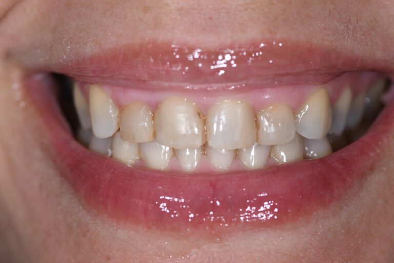 WhatsApp Image 2026-03-17 at 2.01