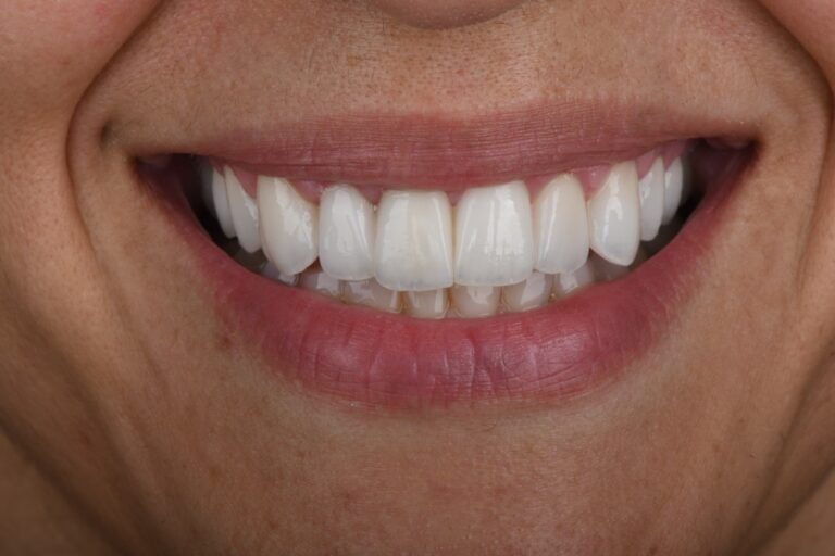 WhatsApp Image 2026-03-17 at 2.02